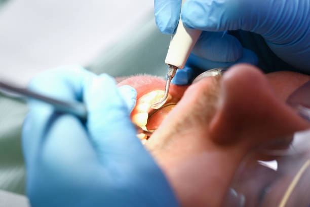 Best Broken Tooth Emergency  in Rm Beach, WA