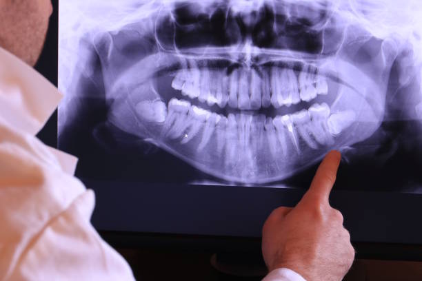 Emergency Dentist for Kids in WA