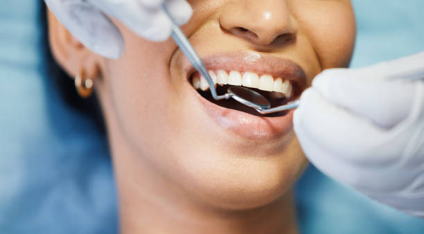 Best Cracked Tooth Emergency Dentist  in Rm Beach, WA