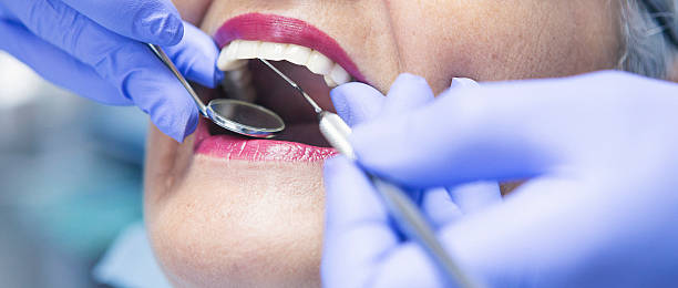 Best Chipped Tooth Repair Near Me  in Rm Beach, WA